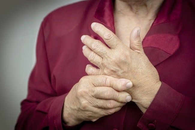 rheumatoid arthritis - Alodokter